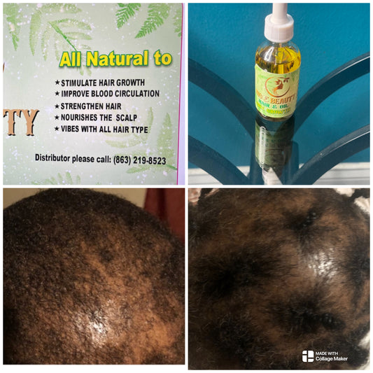Hair growth oil